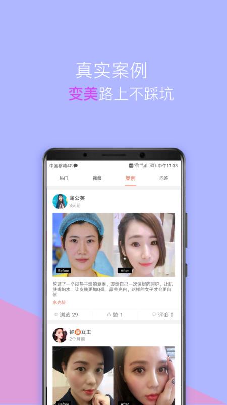 塑美图3