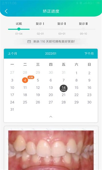 青椒美牙图4
