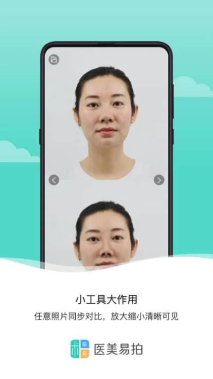 医美易拍app图3